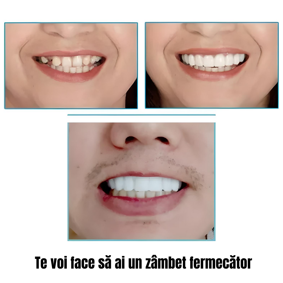 Proteză dentară cosmetică