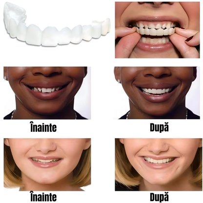 Proteză dentară cosmetică