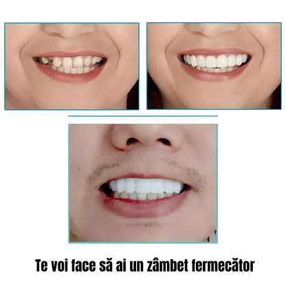 Proteză dentară cosmetică